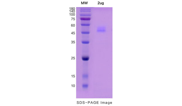 Recombinant Human Ceacam6 Protein ,c- His Tag-atagenix